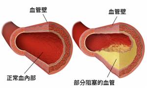 arteries
