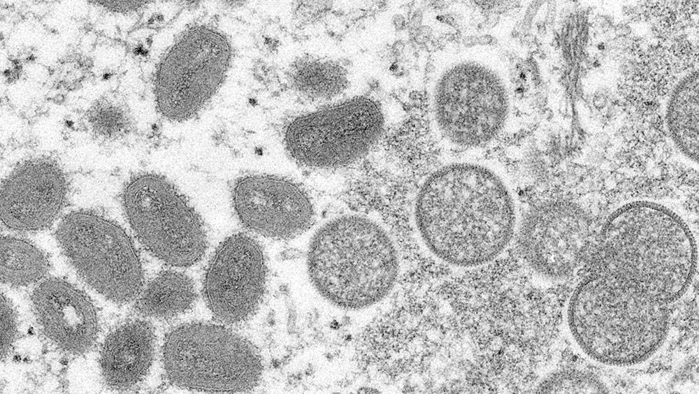 再多8國出現首宗個案 專家 : 猴痘變異速度比預期快12倍