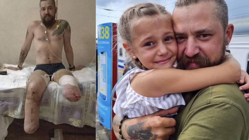 俄烏局勢｜獸醫上戰場 烏克蘭網紅淚訴姊夫雙腳慘被炸斷