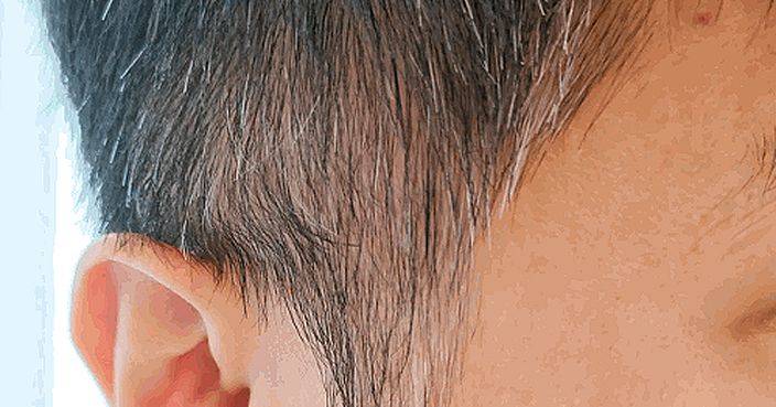 “Gray hair may indicate a gastrointestinal problem: Tips from Chinese medicine practitioners on how to restore black hair”