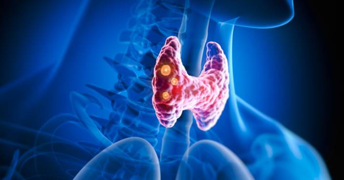 浙江12歲女童確診甲狀腺癌 醫生：兒童發生率低但惡性率高